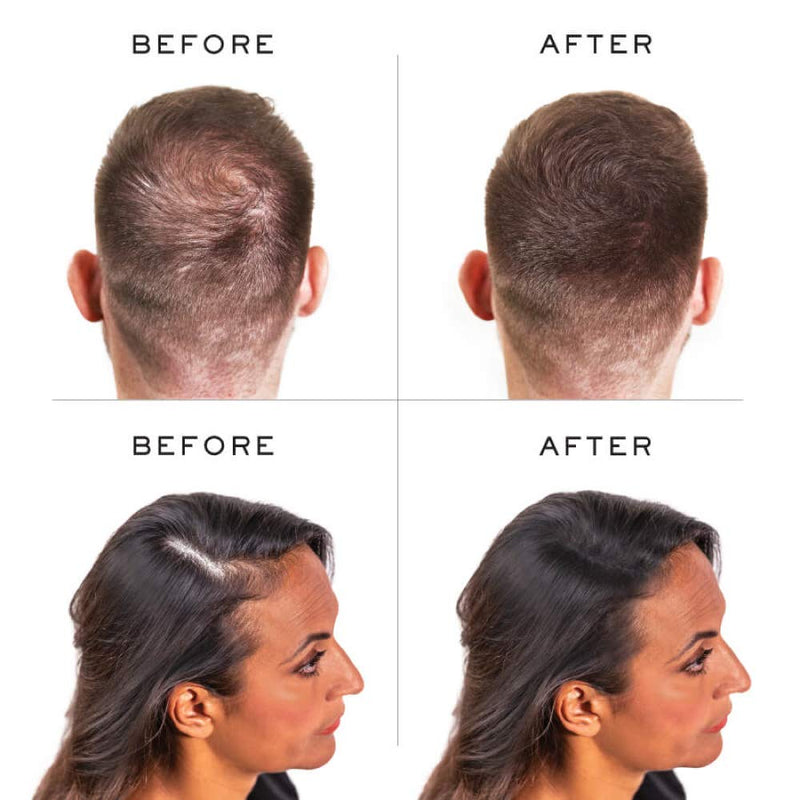 Nanogen Keratin Hair Fibers,